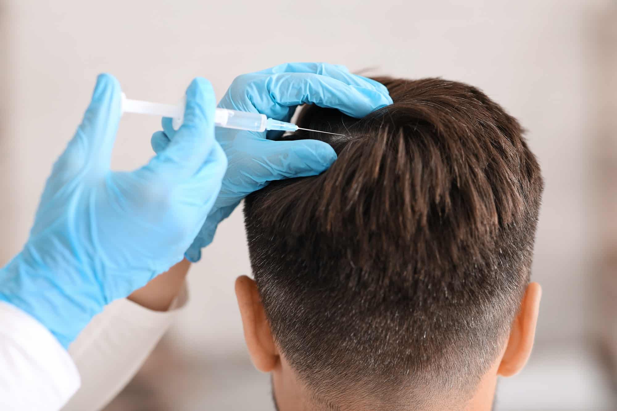 Unrecognizable man having hair treatment at beauty salon by Avia Medical Spa in the United States