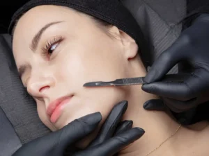 dermaplaning by Avia Medical Spa in United States