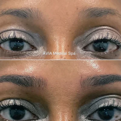 Eyebrow-Microblading-Microshading-Combo by Avia Medical Spa in the United States