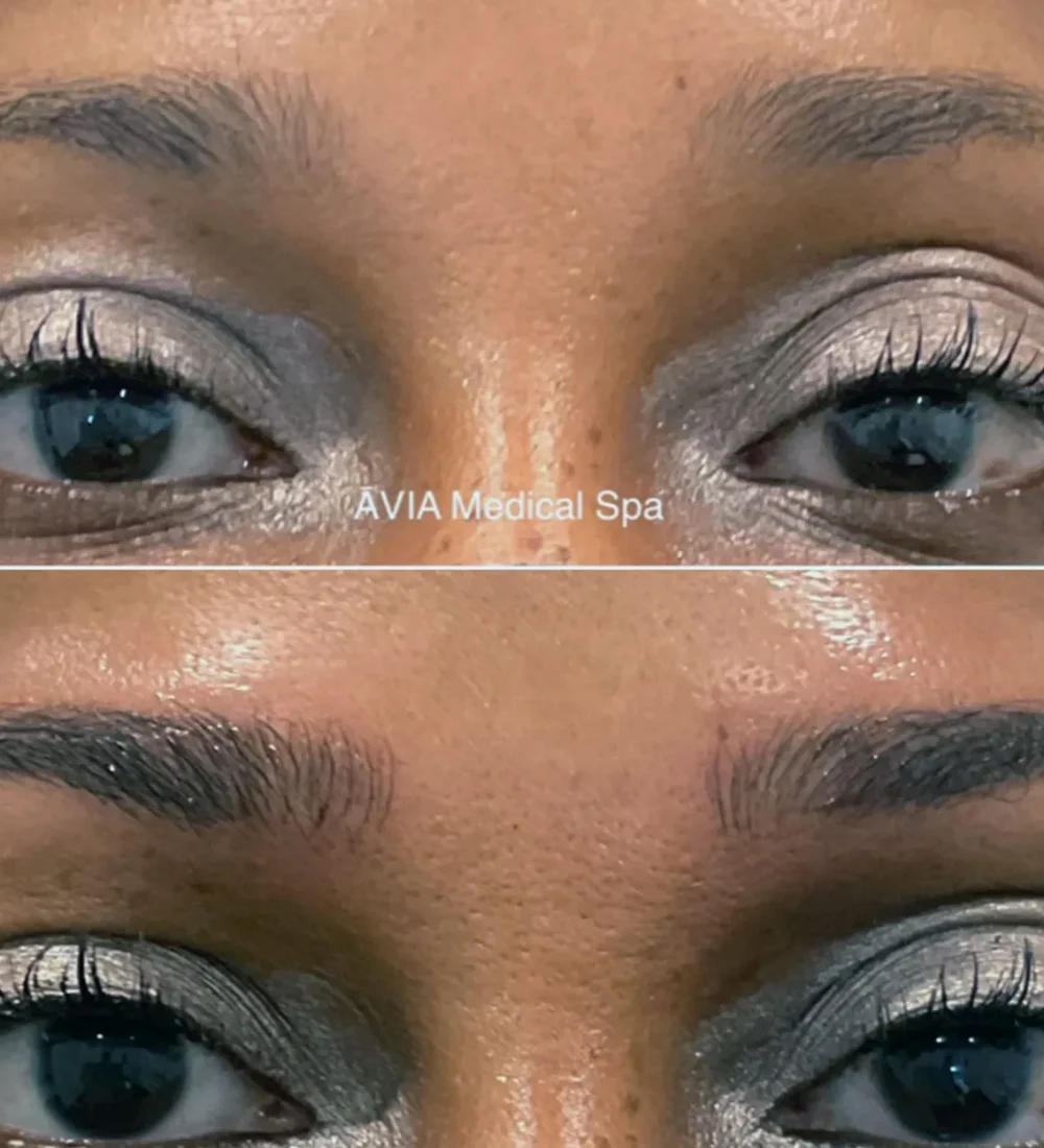 Eyebrow-Microblading-Microshading-Combo by Avia Medical Spa in the United States
