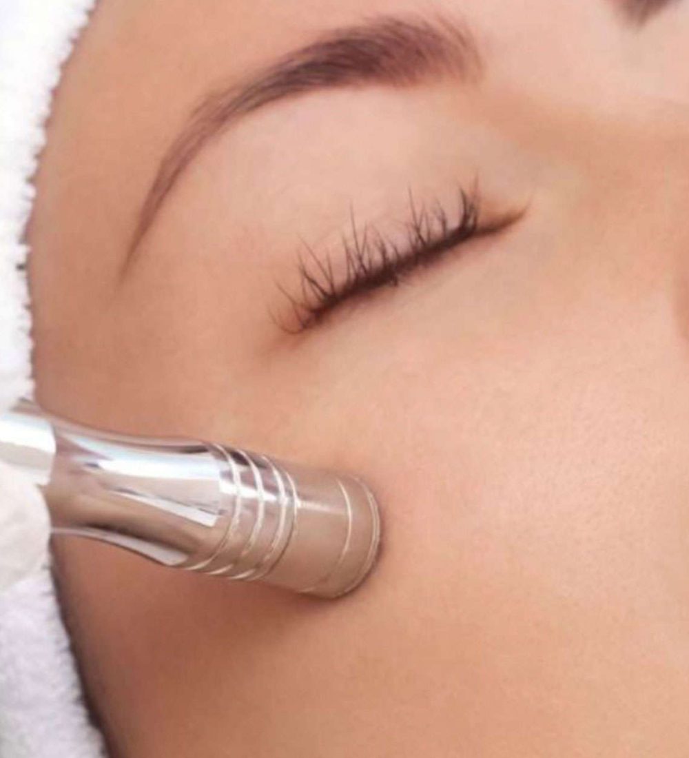 Microdermabrasion-Facial by Avia Medical Spa in the United States