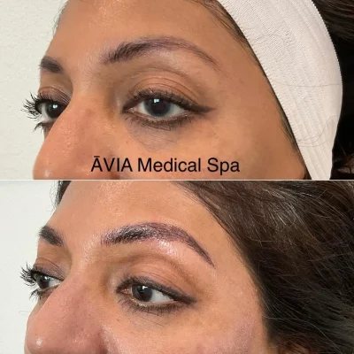 gallery nineteen by Avia Medical Spa in the United States