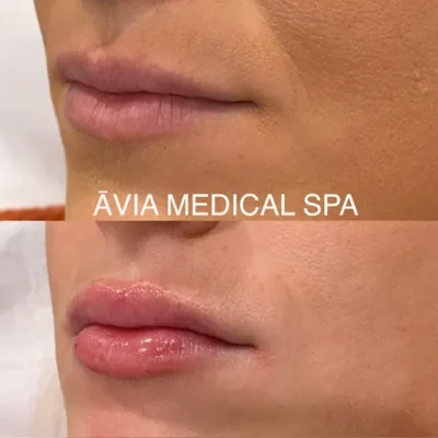 image27 by Avia Medical Spa in united states