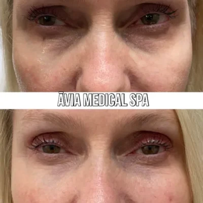 image28 by Avia Medical Spa in united states