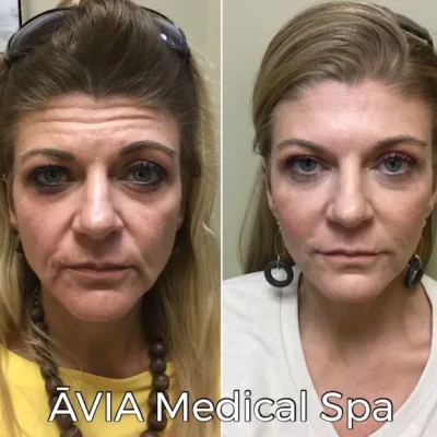 image31 by Avia Medical Spa in united states