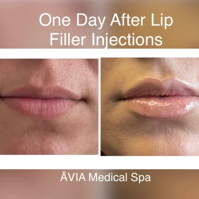 image7 by Avia Medical Spa in united states