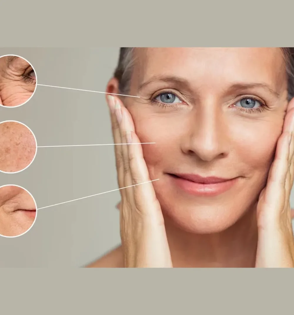 sculptra by Avia Medical Spa in united states