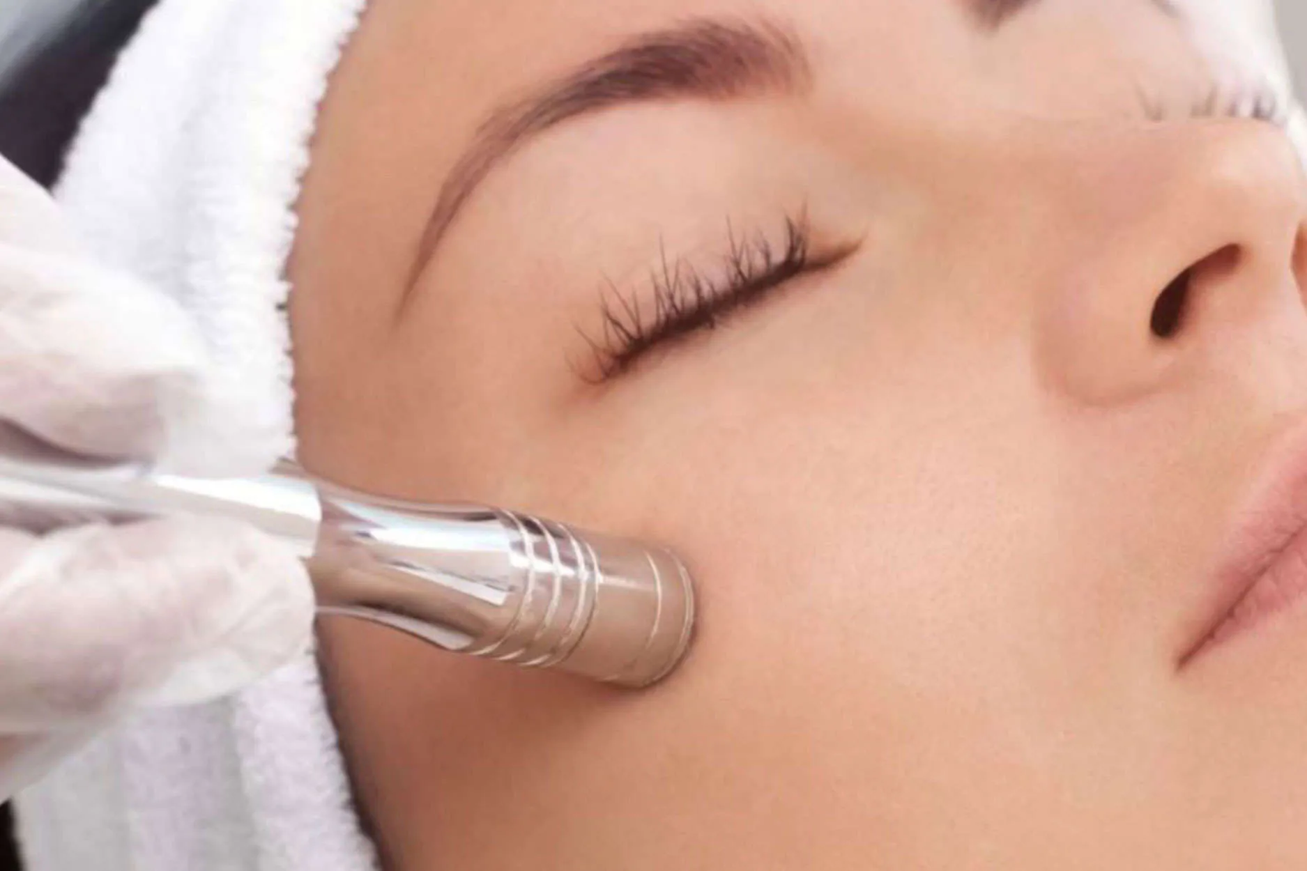 Microdermabrasion-Facial-1
