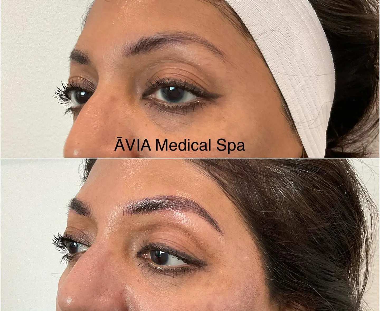 gallery nineteen by Avia Medical Spa in the United States