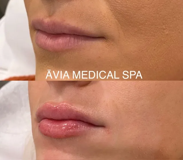 image27 by Avia Medical Spa in united states