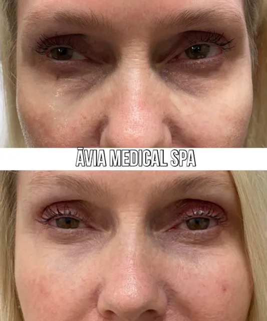 image28 by Avia Medical Spa in united states