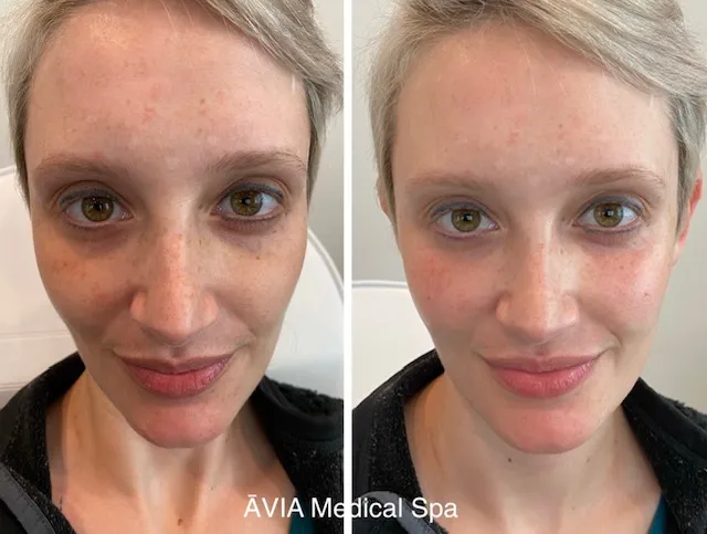 image32 by Avia Medical Spa in united states