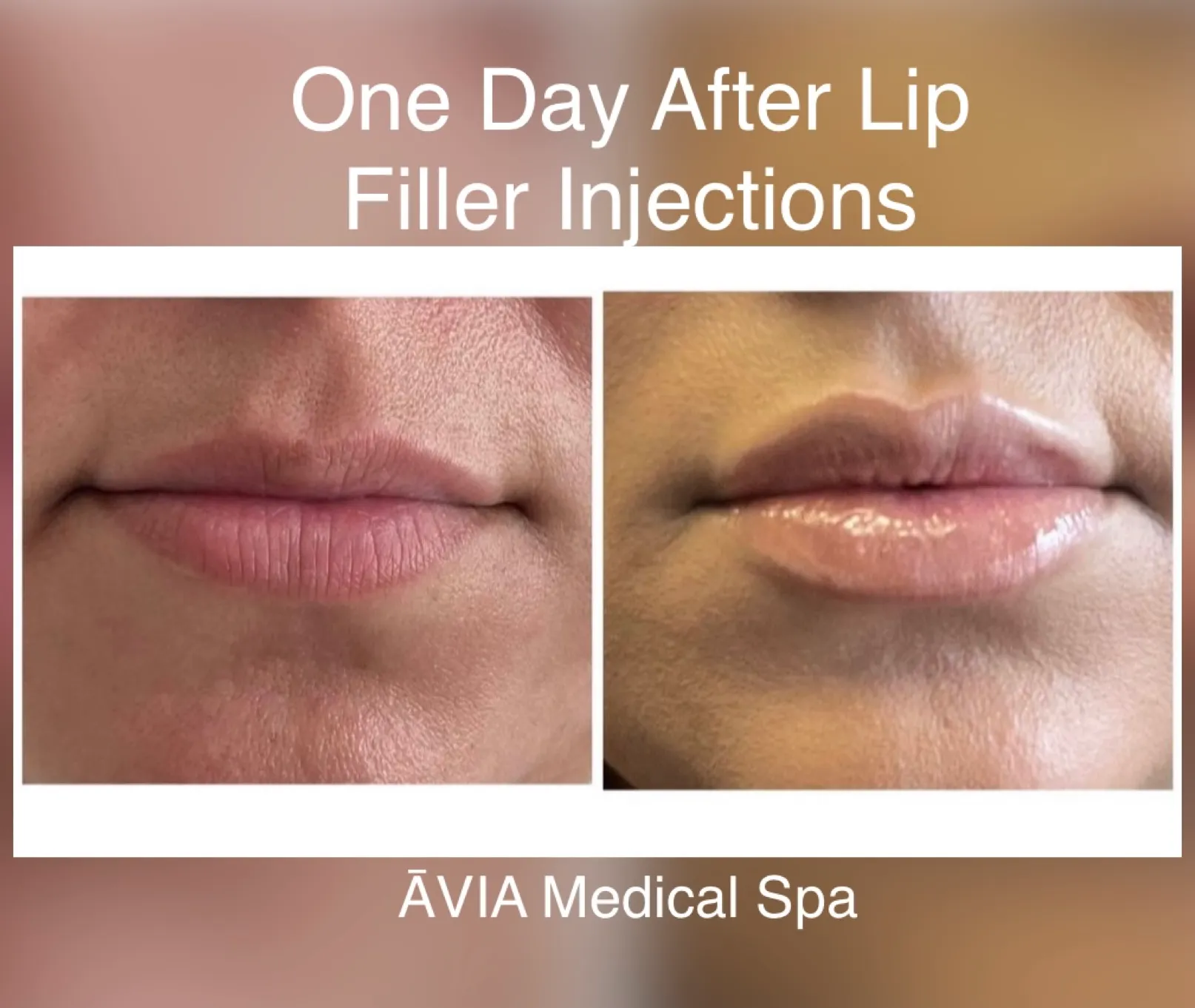 image7 by Avia Medical Spa in united states