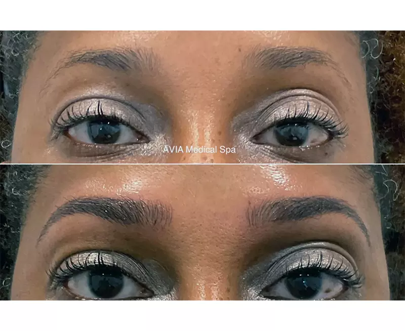 1_0059_Eyebrow-Microblading-Microshading-Combo