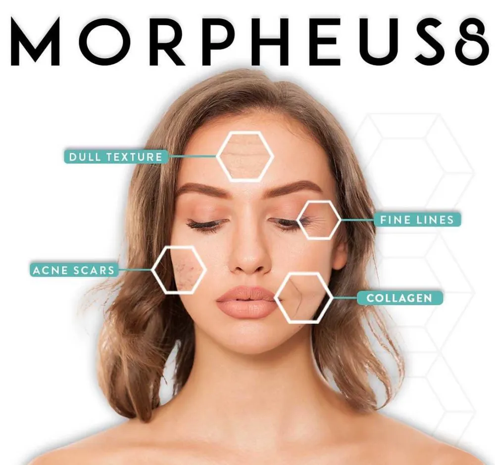 a.Morpheus-8-Face-and-Neck.webp