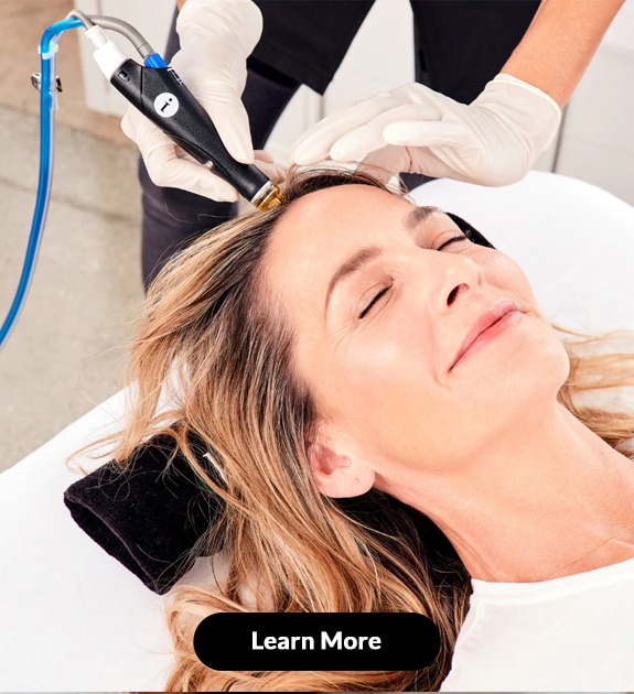 MOXI Laser Treatment