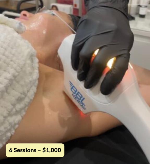 Laser Special